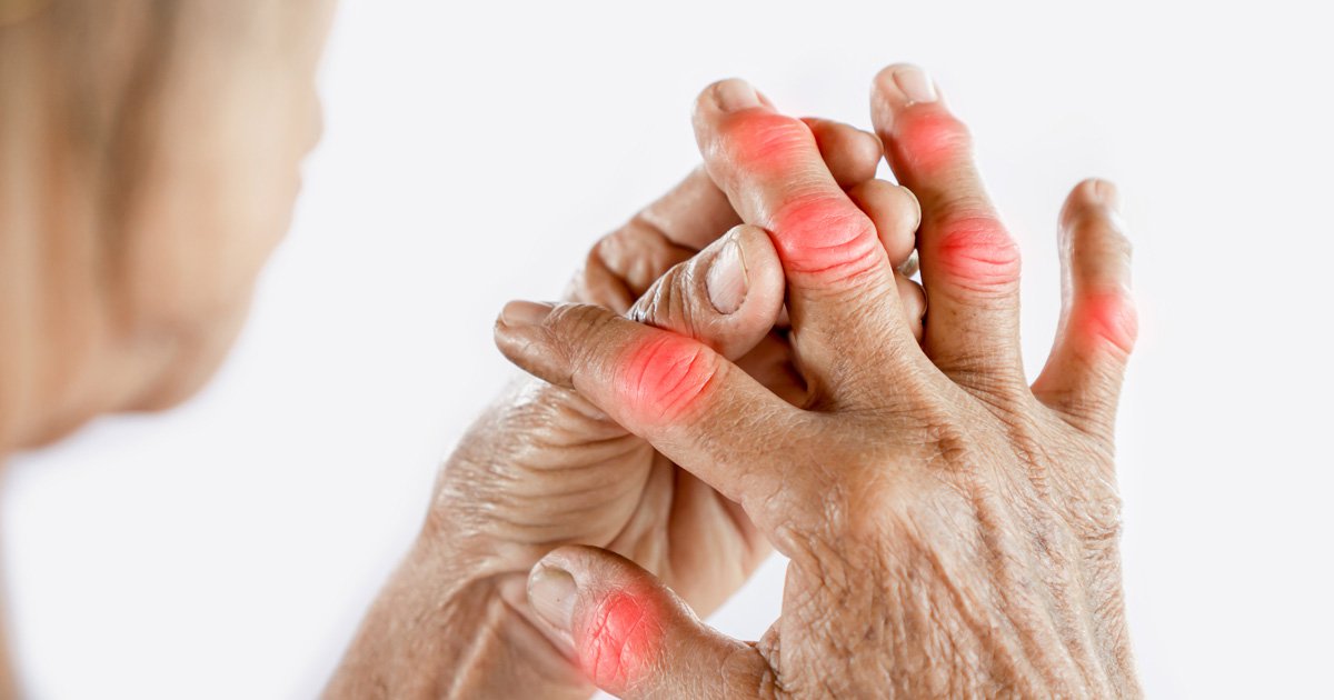 Rheumatoid Arthritis; Signs, Symptoms and Causes