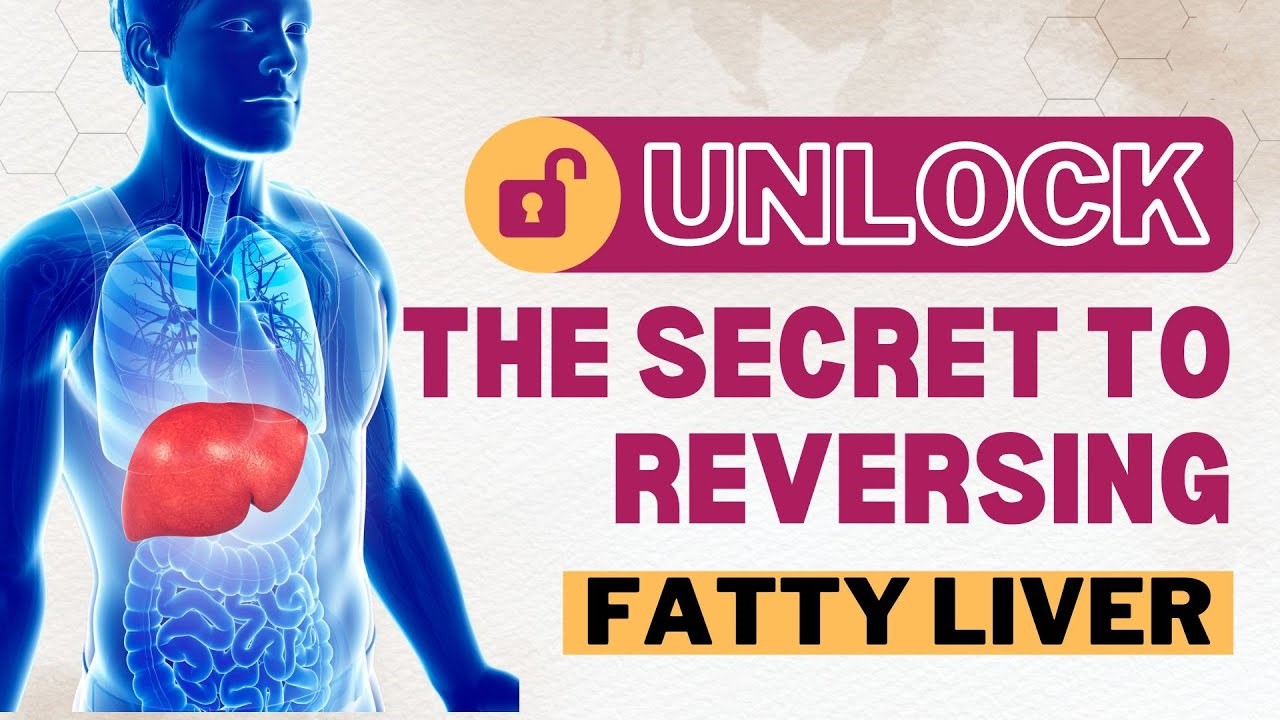 Reclaiming Your Health: A Comprehensive Guide to Reversing Fatty Liver Disease