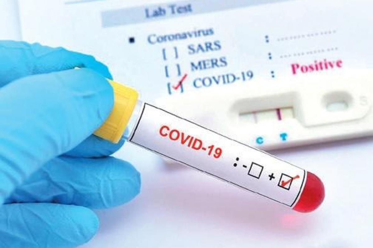 COVID19 Positive cases increase manifold in J&K; 4926 new infections, 52 Deaths