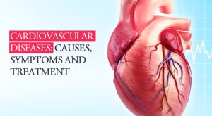 Cardiovascular Diseases Causes and Preventions