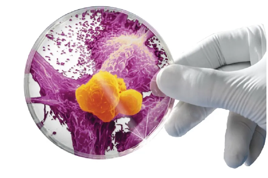 Cancer: A Growing Menace in Kashmir