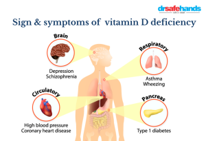 Epidemiological Trends and Clinical Implications of Vitamin D Deficiency: A Multifaceted Public Health Concern