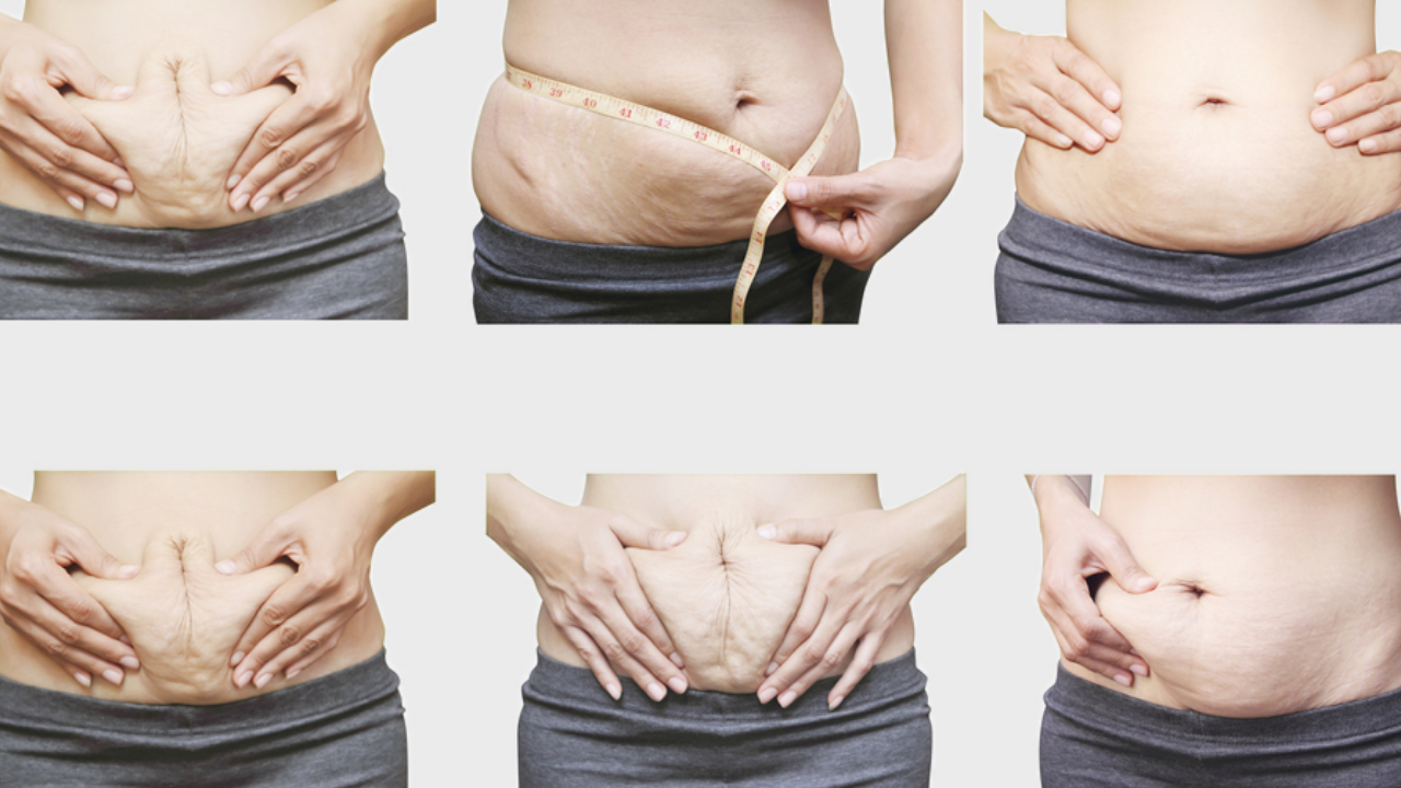 Demystifying Body Fat: Your Guide to a Healthier, Happier You