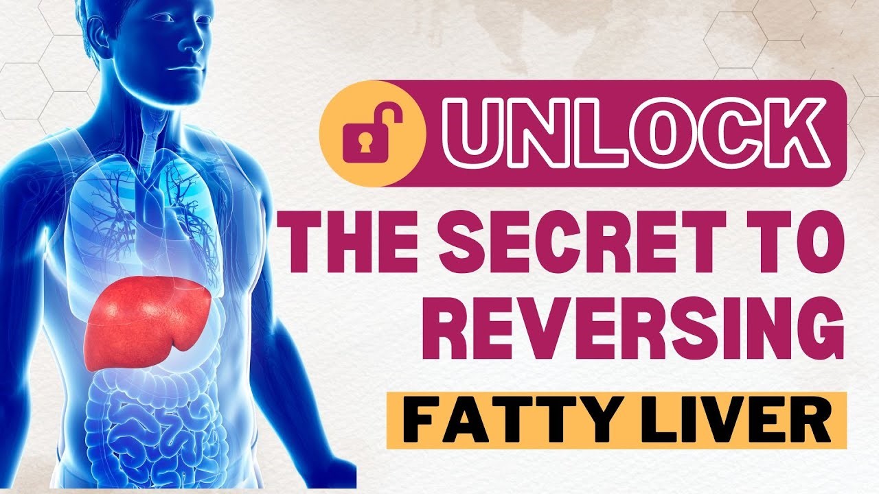 Reclaiming Your Health: A Comprehensive Guide to Reversing Fatty Liver Disease