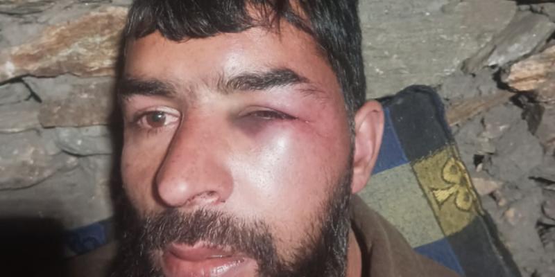 Kishtwar Torture Victim's Family Receives Rs 25,000 and Free Ration from Army