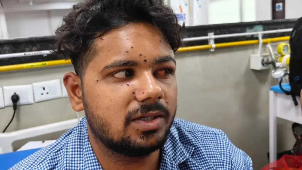 Delhi Pellet Injuries Revive an Amritsar Doctor's Painful Kashmir Memories