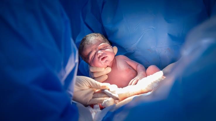 J&K’s C-Section Surge Raises a Bigger Question: Are Caesarean Births Becoming Too Common — and Too Costly?